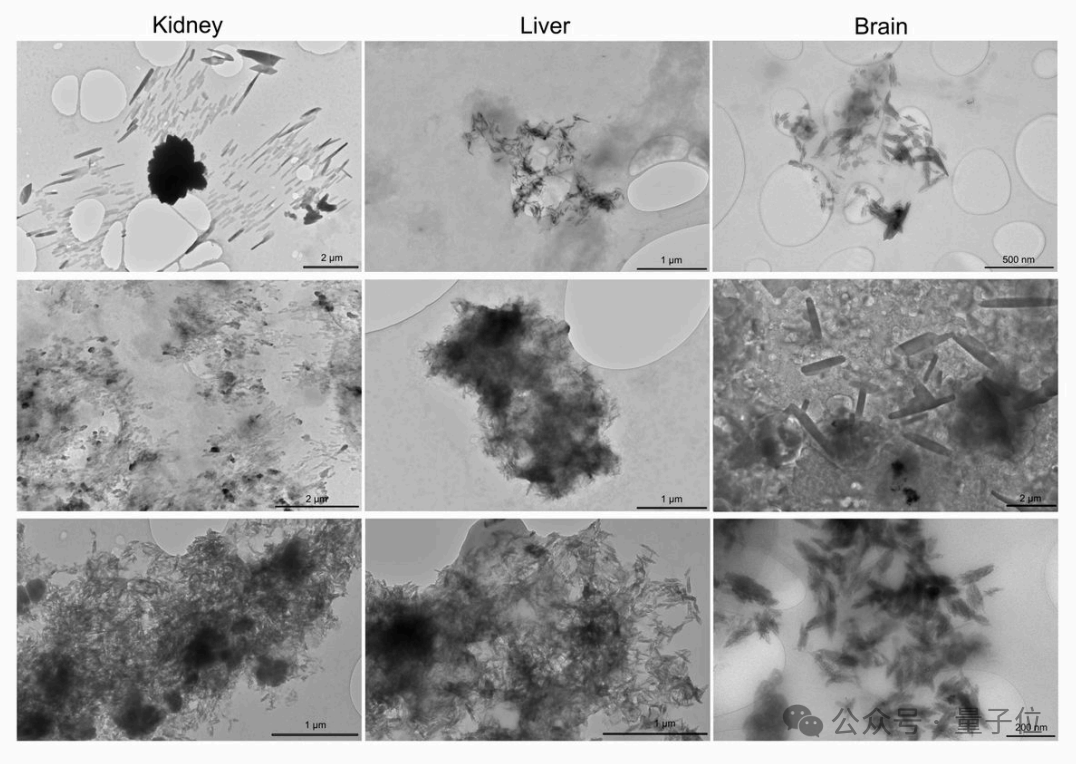 让Karpathy倍感意外的研究：人类大脑已被塑料污染