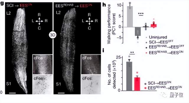 电刺激让瘫痪者重新行走原理找到了，3人已治疗成功 | Nature