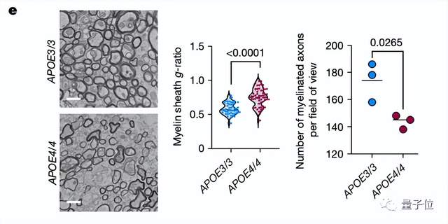 哪种人更易患老年痴呆？MIT团队揭示阿兹海默症背后的基因机制｜Nature