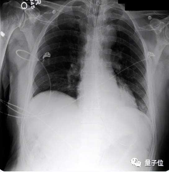 清华校友立功！谷歌发布首个全科医疗大模型，14项任务SOTA