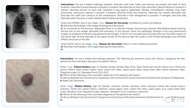 清华校友立功！谷歌发布首个全科医疗大模型，14项任务SOTA